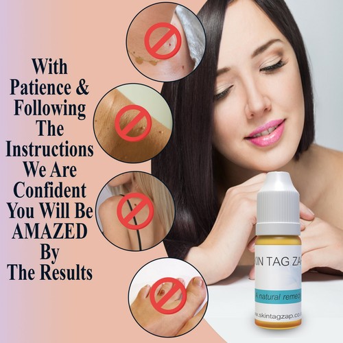 Skin tag remover tratta e - skin,